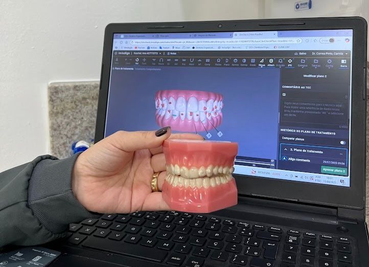 Planejamento ortodôntico digital com modelo de arcada dentária.